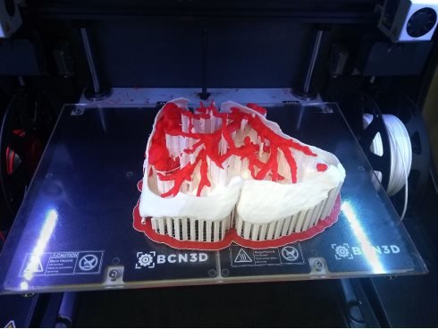 LA TECNOLOGÍA DE IMPRESIÓN 3D DE BCN3D CREA MODELOS BIOMÉDICOS QUE MEJORAN LAS OPERACIONES QUIRÚRGICAS CONTRA EL CÁNCER